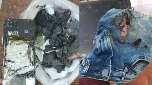 Realme का फोन जेब में हुआ ब्लास्ट, आग लगने से झुलसा युवक, कहा- जाऊंगा कोर्ट