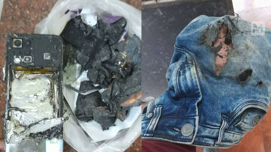Realme का फोन जेब में हुआ ब्लास्ट, आग लगने से झुलसा युवक, कहा- जाऊंगा कोर्ट Realme-8-Blast