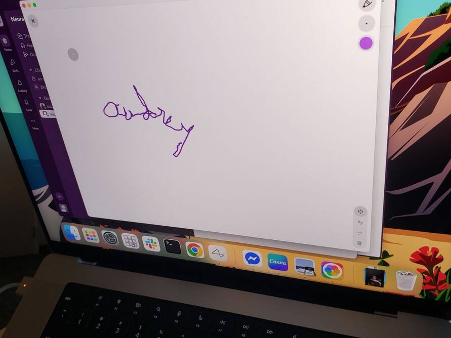 Neuralink Patient Writes Using Only Her Thoughts, Elon Musk Confirmed