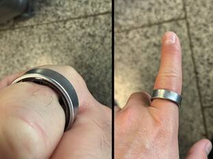 Samsung Faces Battery Trouble Again? Galaxy Ring Swells Up, Hurts User Mid-Trip