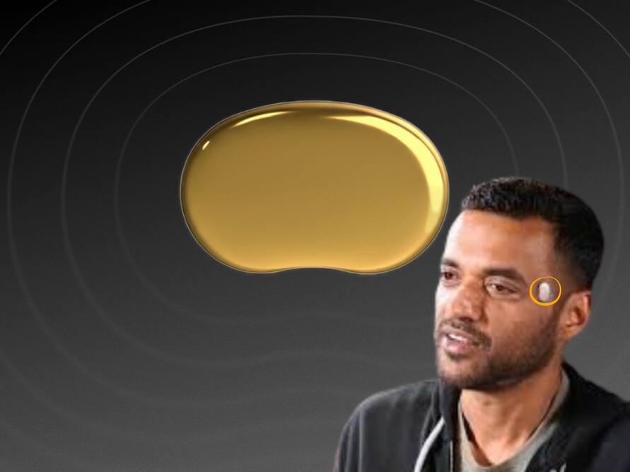 Zomato CEO Deepinder Goyal Breaks Silence On Viral Temple Device: What Is It?